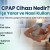 CPAP Cihazı Nedir? Ne İşe Yarar ve Nasıl Kullanılır?